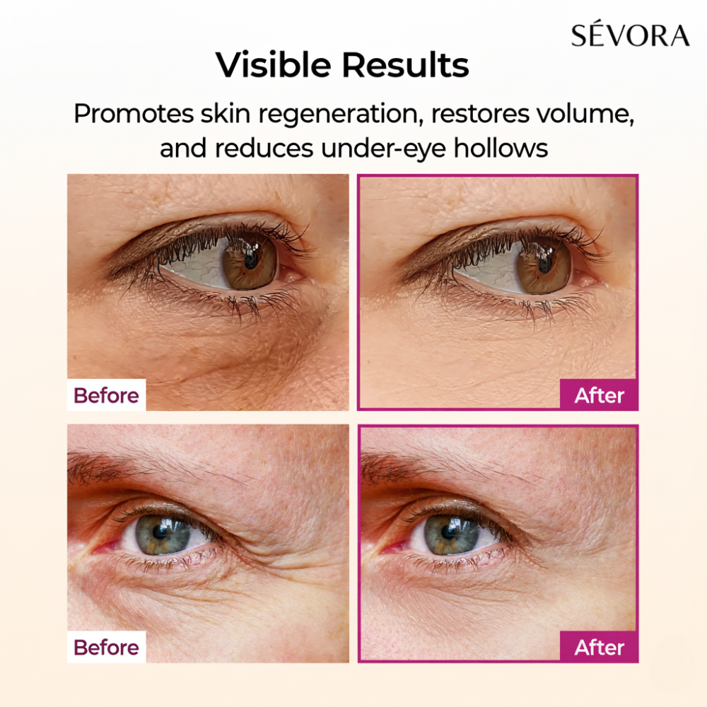 SÉVORA - Calcium Anti-Aging Balm